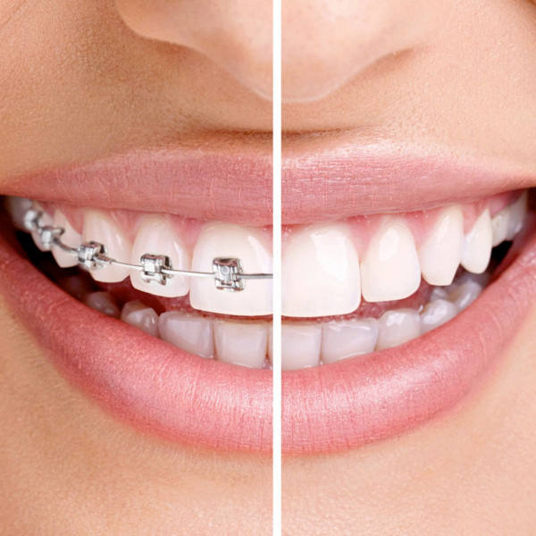 dentista ORTODONZIA verona